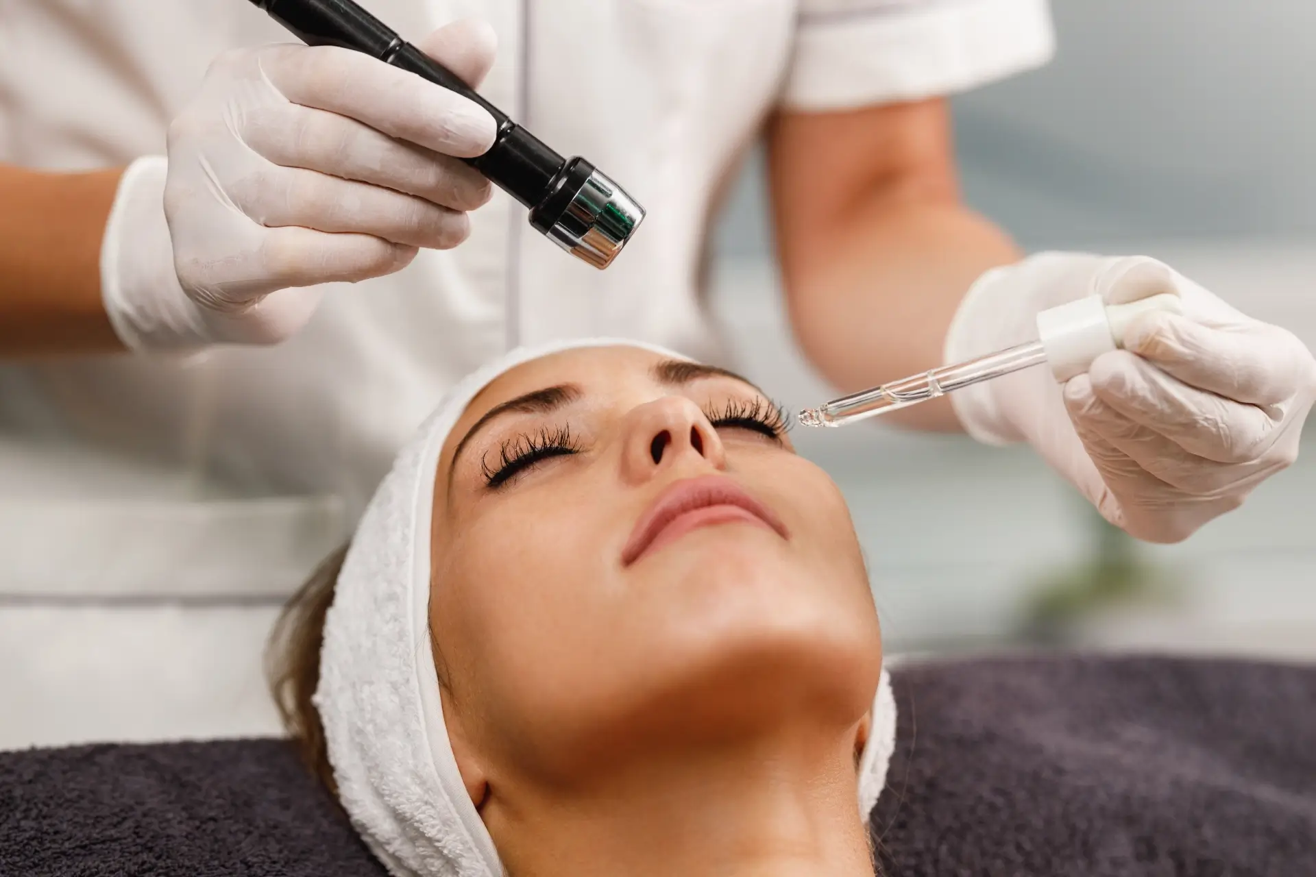 Fractional laser resurfacing for acne scars at Flawless Derma Centre in Winnipeg